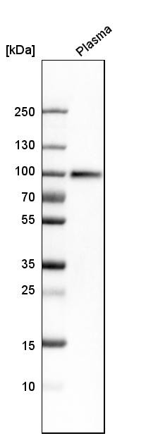 Western blot analysis in human plasma.