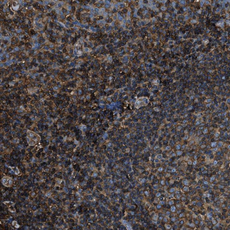 Immunohistochemical staining of human tonsil shows strong cytoplasmic positivity.