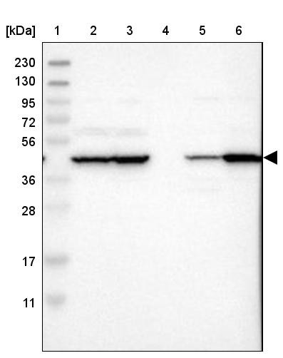 Lane 1: Marker [kDa] 230, 130, 95, 72, 56, 36, 28, 17, 11<br/>Lane 2: Human cell line RT-4<br/>Lane 3: Human cell line U-251MG sp<br/>Lane 4: Human plasma (IgG/HSA depleted)<br/>Lane 5: Human liver tissue<br/>Lane 6: Human tonsil tissue