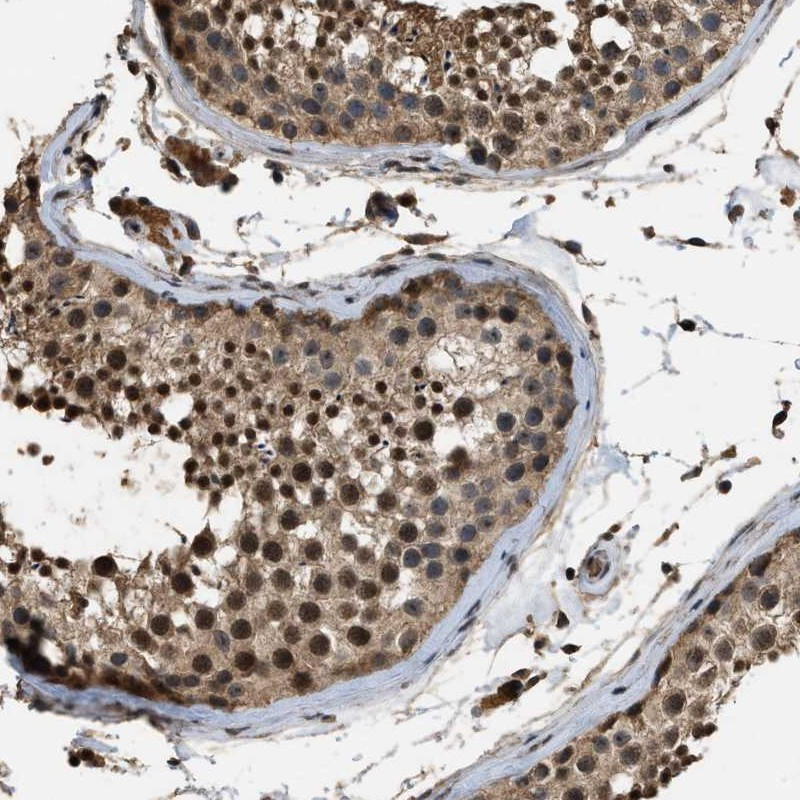 Immunohistochemical staining of human testis shows cytoplasmic and nuclear positivity in cells in seminiferus ducts.