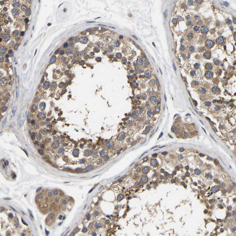 Immunohistochemical staining of human testis shows weak to moderate cytoplasmic positivity in cells in seminiferous ducts.