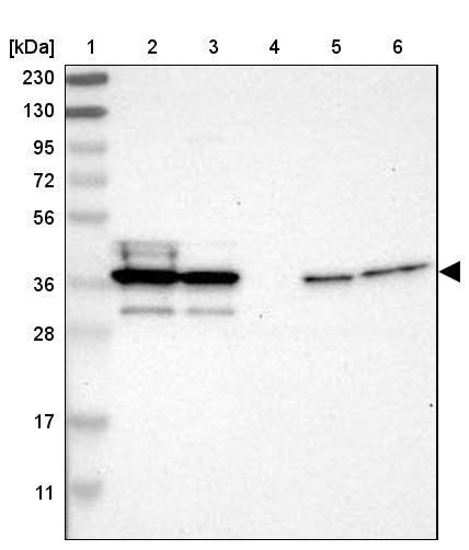 Lane 1: Marker [kDa] 230, 130, 95, 72, 56, 36, 28, 17, 11<br/>Lane 2: Human cell line RT-4<br/>Lane 3: Human cell line U-251MG sp<br/>Lane 4: Human plasma (IgG/HSA depleted)<br/>Lane 5: Human liver tissue<br/>Lane 6: Human tonsil tissue