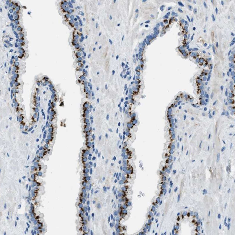 Immunohistochemical staining of human prostate shows strong cytoplasmic positivity, with a granular pattern, in glandular cells.