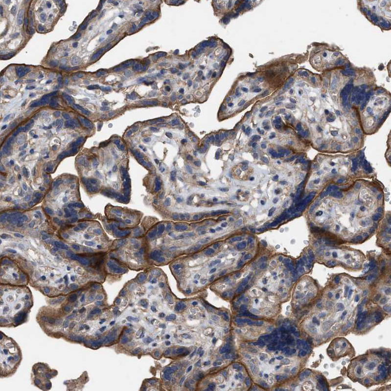Immunohistochemical staining of human placenta shows strong membranous positivity in trophoblastic cells.