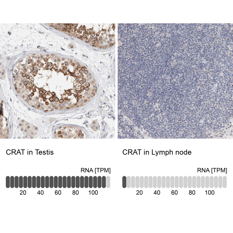 Immunohistochemistry analysis in human testis and lymph node tissues using HPA019230 antibody. Corresponding CRAT RNA-seq data are presented for the same tissues.