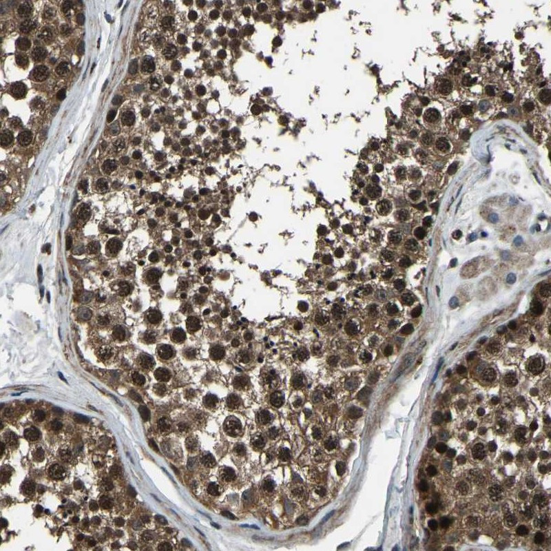 Immunohistochemical staining of human testis shows nuclear and cytoplasmic positivity in cells of seminiferus ducts.