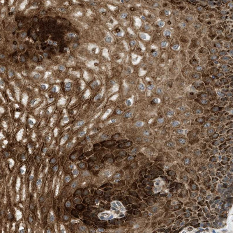 Immunohistochemical staining of human esophagus shows strong cytoplasmic positivity in squamous epithelial cells.