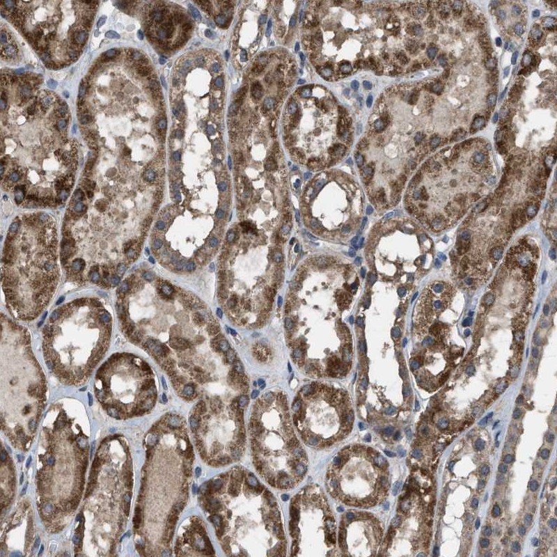 Immunohistochemical staining of human kidney shows strong cytoplasmic positivity in tubuli.