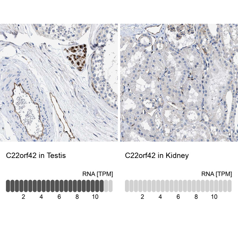 Immunohistochemistry analysis in human testis and kidney tissues using Anti-C22orf42 antibody. Corresponding C22orf42 RNA-seq data are presented for the same tissues.