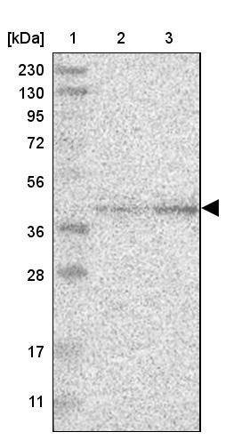 Lane 1: Marker [kDa] 230, 130, 95, 72, 56, 36, 28, 17, 11<br/>Lane 2: Human cell line RT-4<br/>Lane 3: Human cell line U-251MG sp