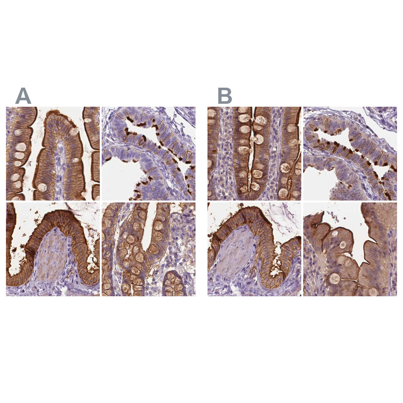 Immunohistochemical staining of human duodenum, fallopian tube, gallbladder and small intestine using Anti-ANXA13 antibody HPA019650 (A) shows similar protein distribution across tissues to independent antibody HPA018535 (B).