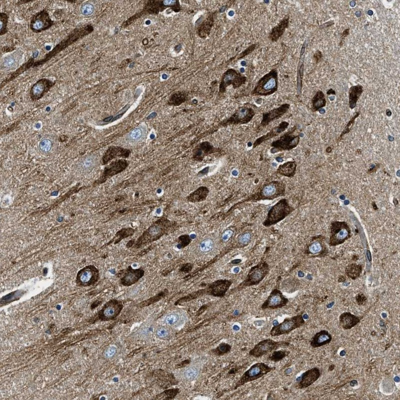 Immunohistochemical staining of human hippocampus shows cytoplasmic positivity in neuronal cells.
