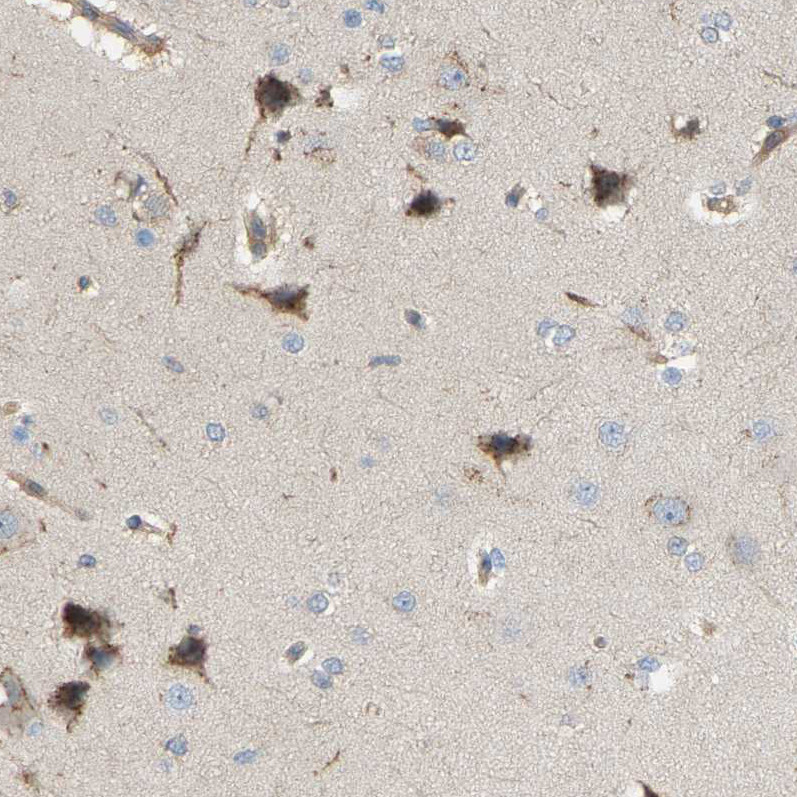 Immunohistochemical staining of human cerebral cortex shows moderate cytoplasmic positivity in neurons.