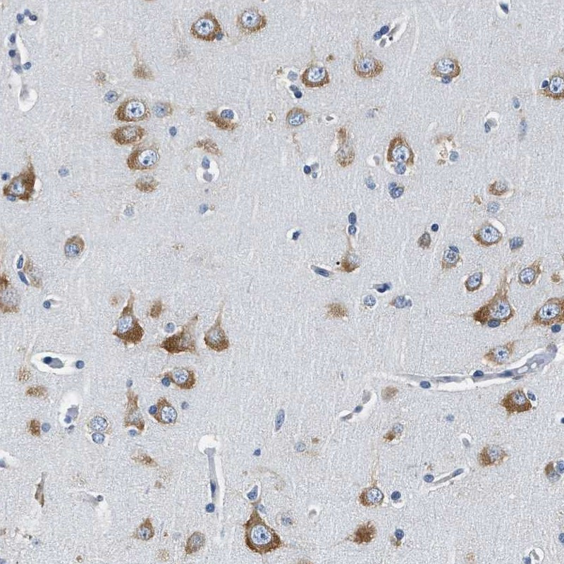 Immunohistochemical staining of human cerebral cortex shows cytoplasmic positivity in neuronal cells.