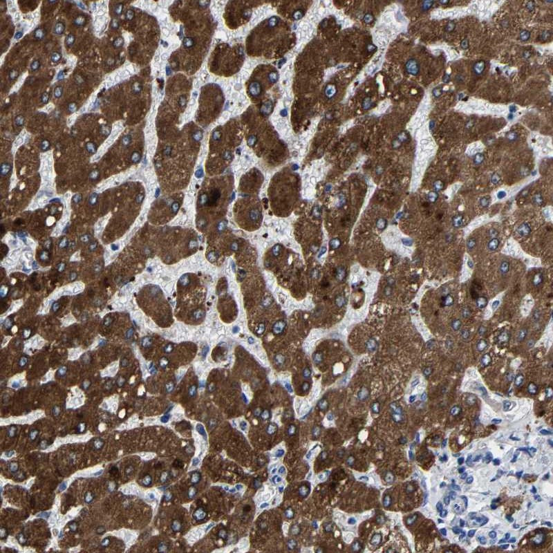 Immunohistochemical staining of human liver shows strong cytoplasmic positivity in hepatocytes.