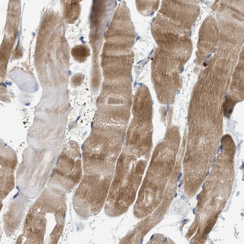 Immunohistochemical staining of human skeletal muscle shows moderate cytoplasmic positivity.