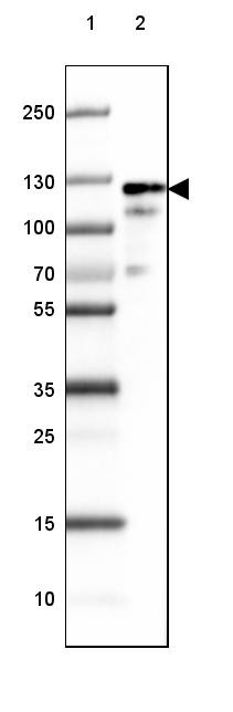 Lane 1: Marker [kDa] 250, 130, 100, 70, 55, 35, 25, 15, 10<br/>Lane 2: Human Cerebral Cortex tissue