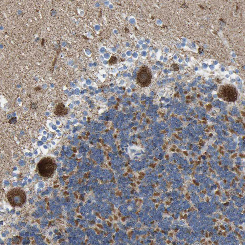 Immunohistochemical staining of human cerebellum shows strong granular cytoplasmic positivity in Purkinje cells.