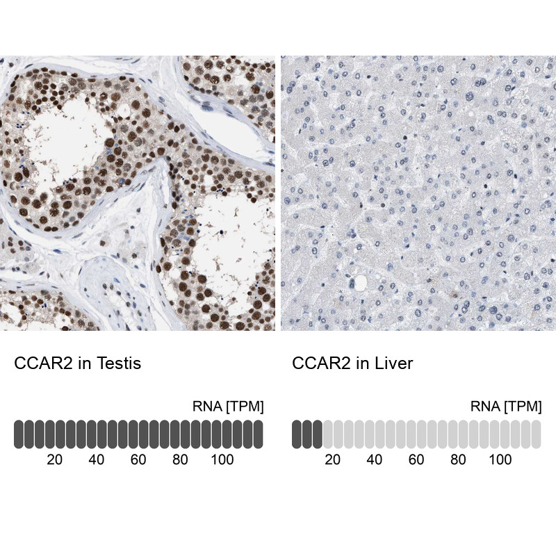 Immunohistochemistry analysis in human testis and liver tissues using HPA019907 antibody. Corresponding CCAR2 RNA-seq data are presented for the same tissues.