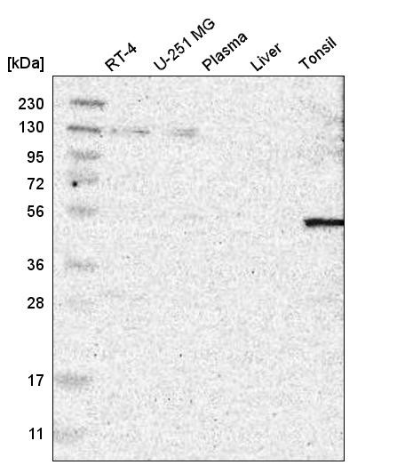 Western blot analysis in human cell line RT-4, human cell line U-251 MG, human plasma, human liver tissue and human tonsil tissue.