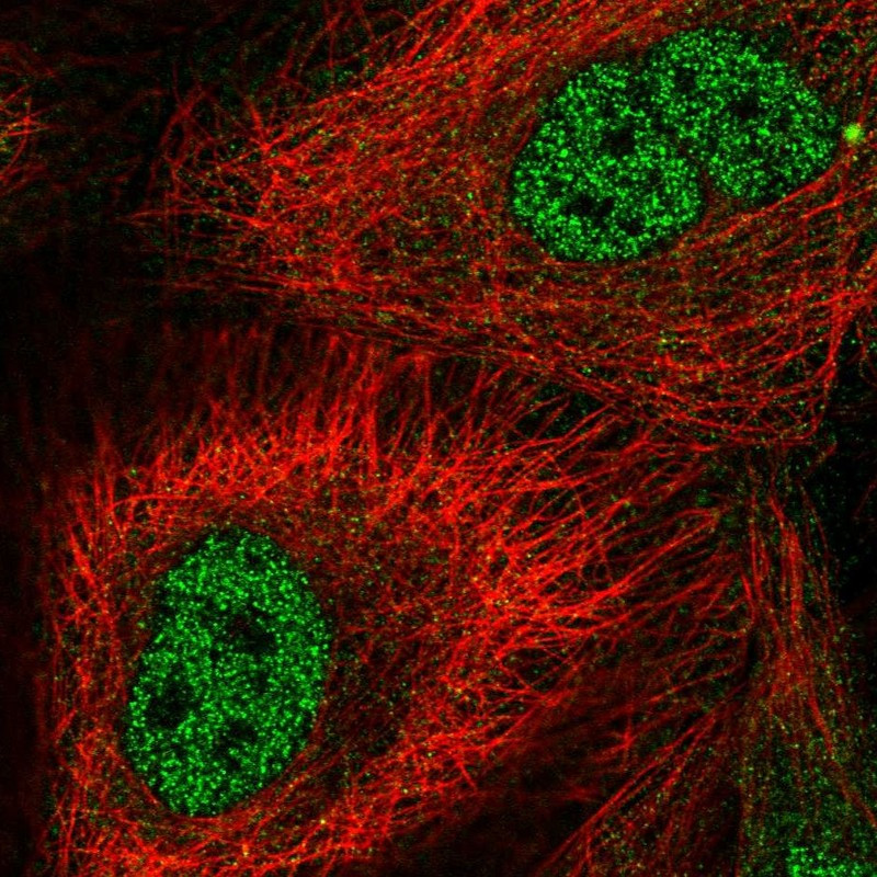 Immunofluorescent staining of human cell line A-431 shows localization to nucleoplasm.