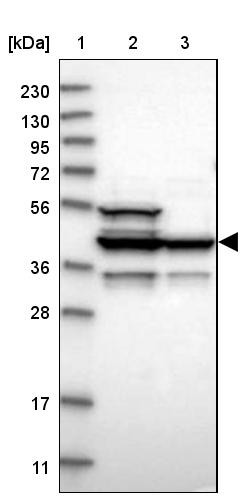 Lane 1: Marker [kDa] 230, 130, 95, 72, 56, 36, 28, 17, 11<br/>Lane 2: Human cell line RT-4<br/>Lane 3: Human cell line U-251MG sp