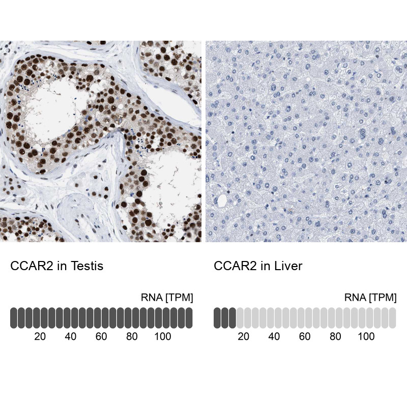 Immunohistochemistry analysis in human testis and liver tissues using HPA019943 antibody. Corresponding CCAR2 RNA-seq data are presented for the same tissues.