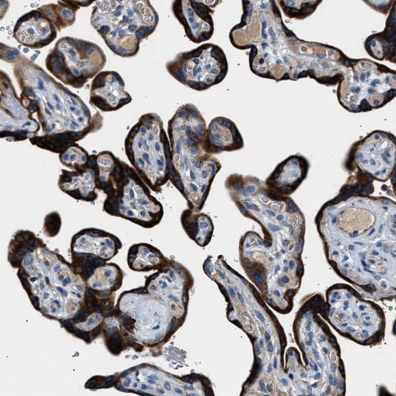 Immunohistochemical staining of human placenta shows strong cytoplasmic positivity in trophoblastic cells.