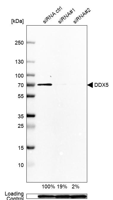 Western blot analysis in Rh30 cells transfected with control siRNA, target specific siRNA probe #1 and #2, using Anti-DDX5 antibody. Remaining relative intensity is presented. Loading control: Anti-GAPDH.