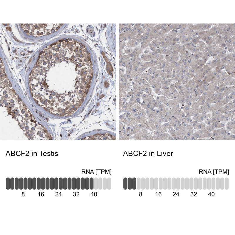 Immunohistochemistry analysis in human testis and liver tissues using Anti-ABCF2 antibody. Corresponding ABCF2 RNA-seq data are presented for the same tissues.