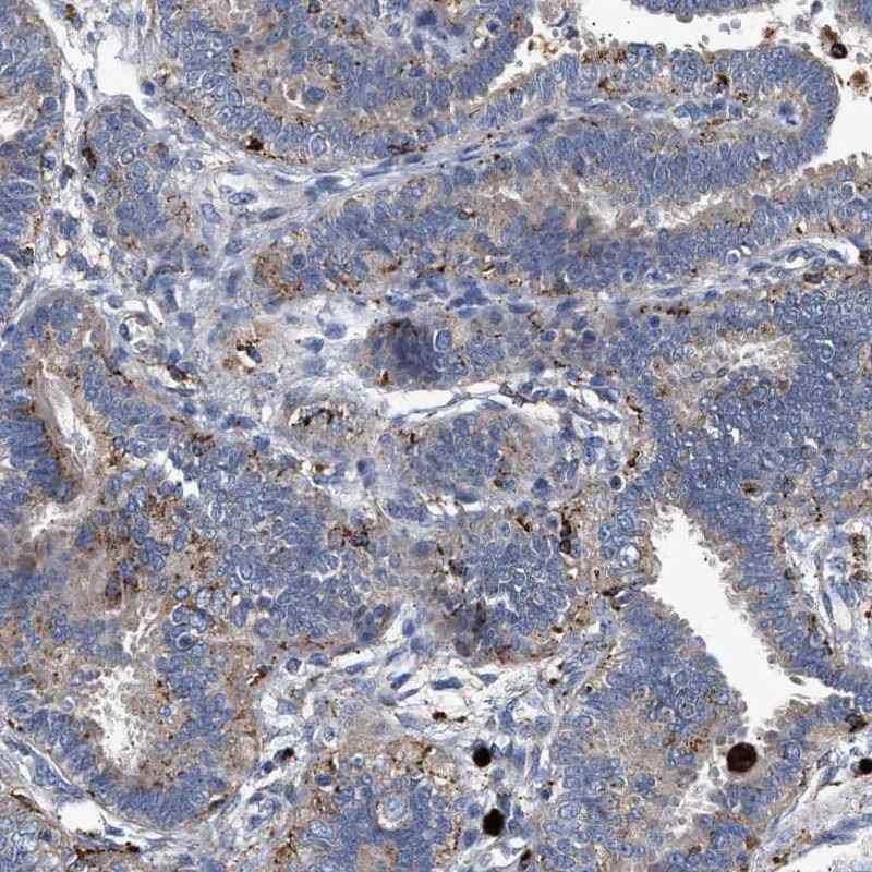 Immunohistochemical staining of human fallopian tube shows weak cytoplasmic positivity in glandular cells.