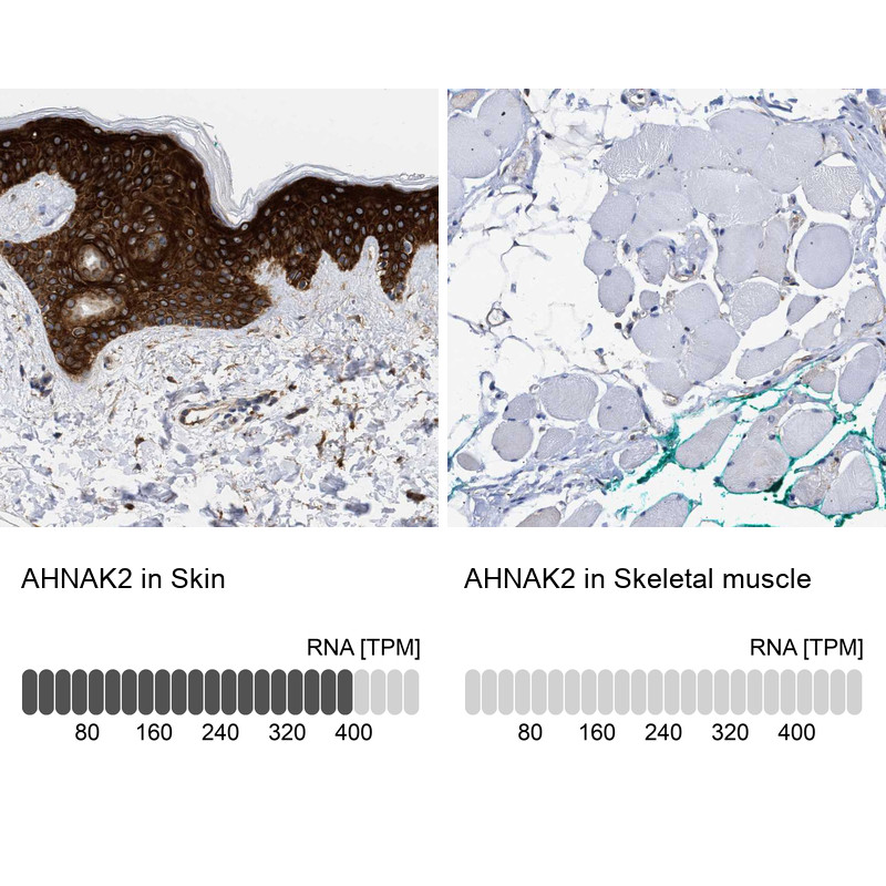 Immunohistochemistry analysis in human skin and skeletal muscle tissues using HPA020111 antibody. Corresponding AHNAK2 RNA-seq data are presented for the same tissues.