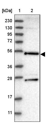 Lane 1: Marker [kDa] 230, 130, 95, 72, 56, 36, 28, 17, 11<br/>Lane 2: Human cell line RT-4