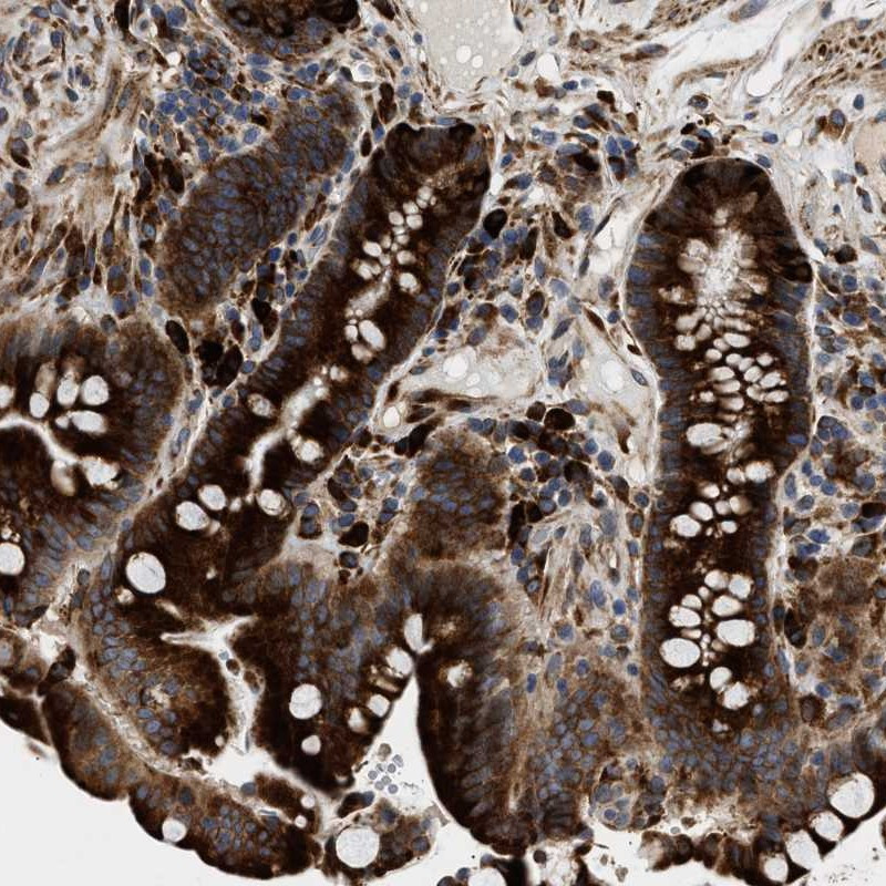 Immunohistochemical staining of human colon shows strong cytoplasmic positivity in glandular cells.