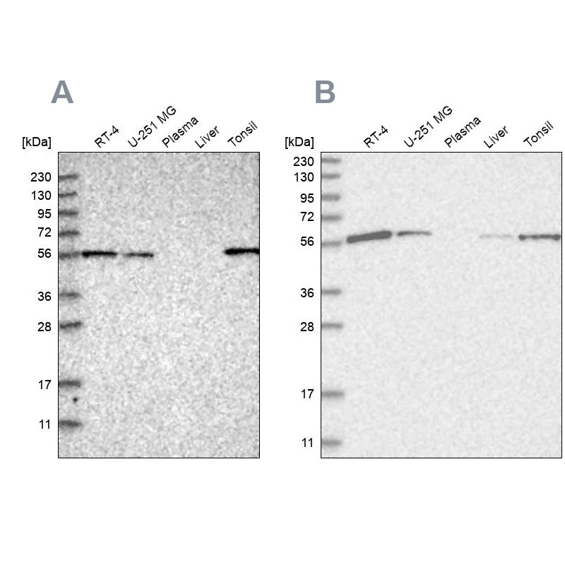 Western blot analysis using Anti-DBNL antibody HPA020265 (A) shows similar pattern to independent antibody HPA027735 (B).