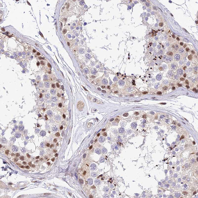 Immunohistochemical staining of human testis shows moderate nuclear positivity in cells in seminiferous ducts.