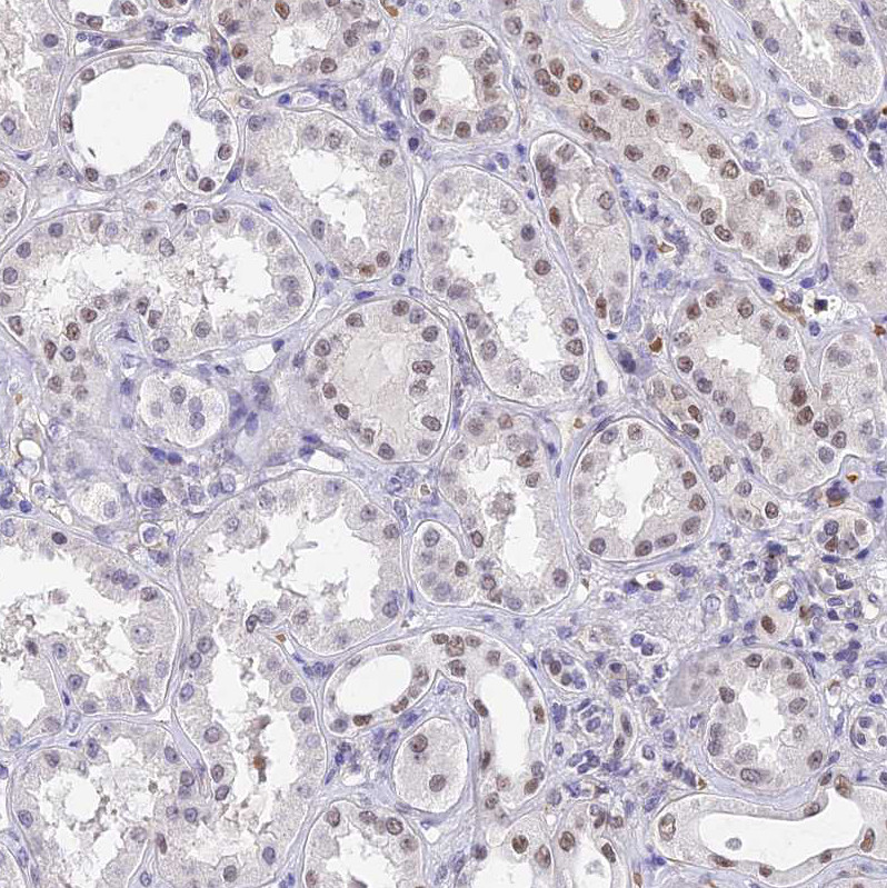Immunohistochemical staining of human kidney shows weak nuclear positivity in cells in tubules.