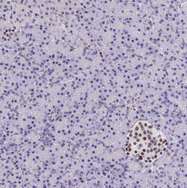 Immunohistochemical staining of human pancreas shows strong nuclear positivity in Langerhans cells, exocrine pancreas was negative as expected