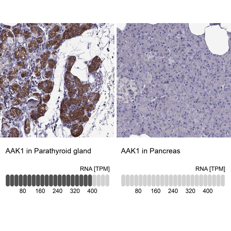 Immunohistochemistry analysis in human parathyroid gland and pancreas tissues using Anti-AAK1 antibody. Corresponding AAK1 RNA-seq data are presented for the same tissues.