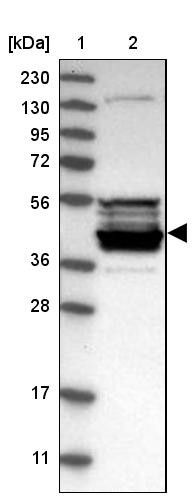 Lane 1: Marker [kDa] 230, 130, 95, 72, 56, 36, 28, 17, 11<br/>Lane 2: Human cell line RT-4