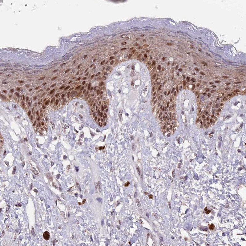 Immunohistochemical staining of human vulva/anal skin shows strong nuclear positivity in epidermal cells.