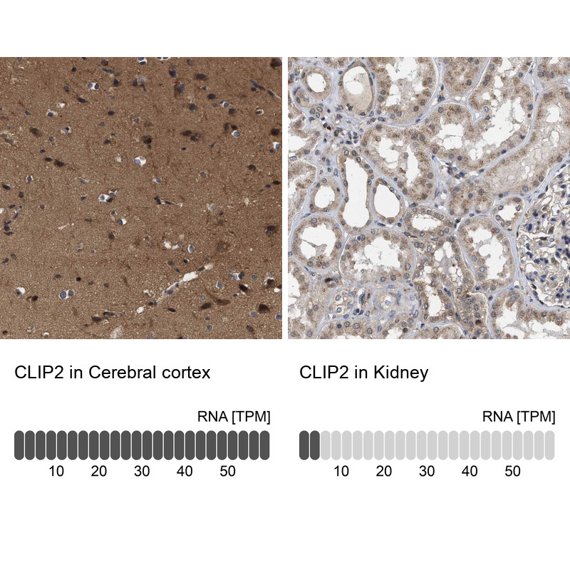 Immunohistochemistry analysis in human cerebral cortex and kidney tissues using Anti-CLIP2 antibody. Corresponding CLIP2 RNA-seq data are presented for the same tissues.