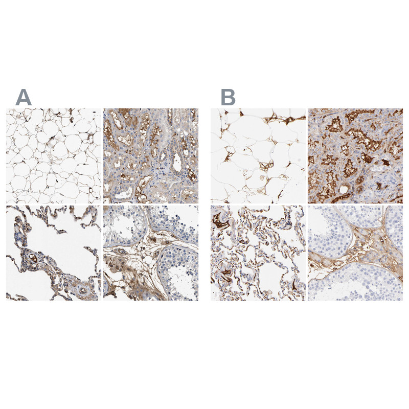 Immunohistochemical staining of human adipose tissue, kidney, lung and testis using Anti-C3 antibody HPA020432 (A) shows similar protein distribution across tissues to independent antibody HPA003563 (B).