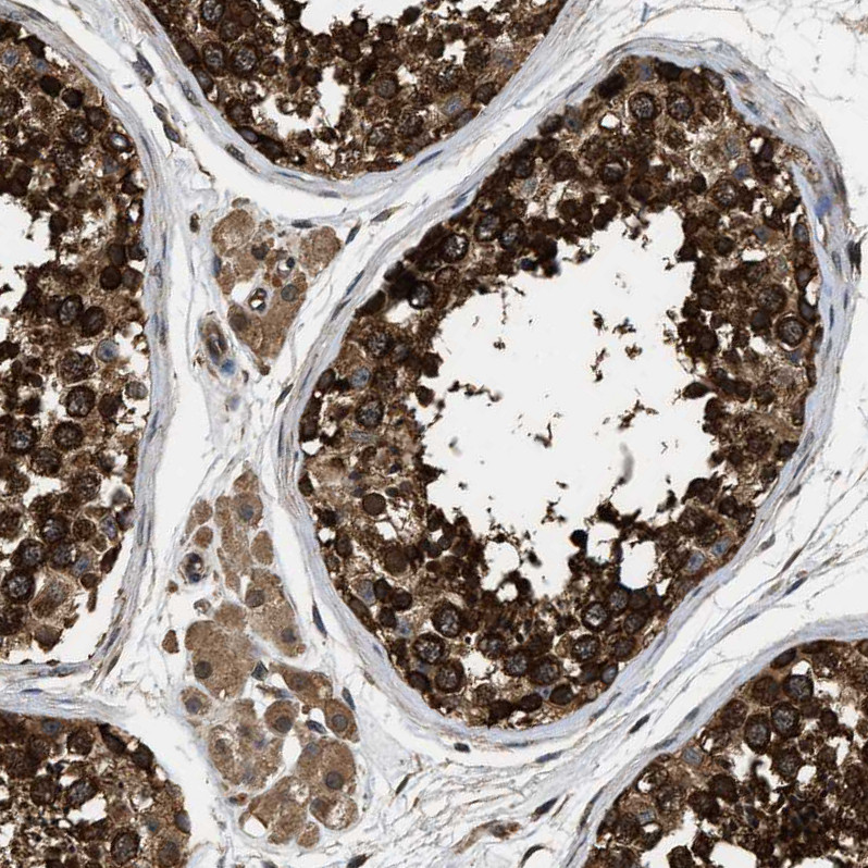 Immunohistochemical staining of human testis shows strong cytoplasmic positivity in cells in seminiferous ducts.