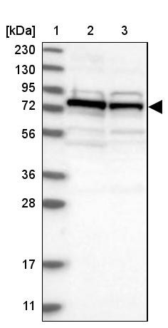 Lane 1: Marker [kDa] 230, 130, 95, 72, 56, 36, 28, 17, 11<br/>Lane 2: Human cell line RT-4<br/>Lane 3: Human cell line U-251MG sp
