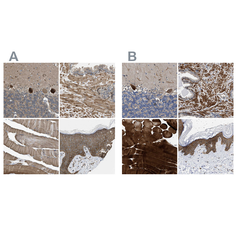 Immunohistochemical staining of human cerebellum, prostate, skeletal muscle and skin using Anti-BAG3 antibody HPA020586 (A) shows similar protein distribution across tissues to independent antibody HPA018493 (B).