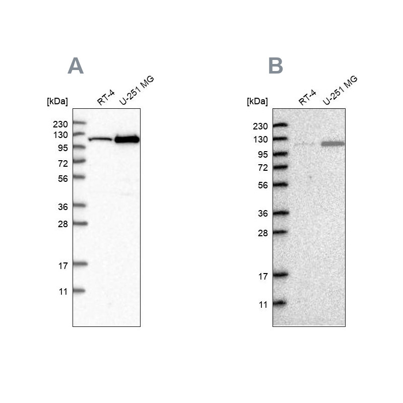 Western blot analysis using Anti-AASS antibody HPA020728 (A) shows similar pattern to independent antibody HPA020637 (B).