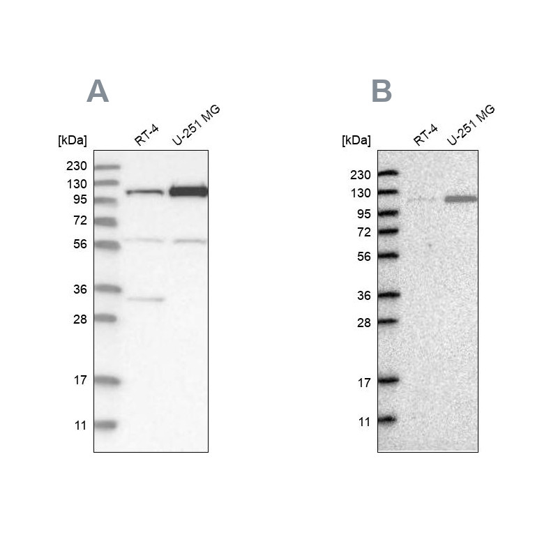 Western blot analysis using Anti-AASS antibody HPA020734 (A) shows similar pattern to independent antibody HPA020637 (B).