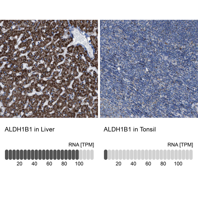 Immunohistochemistry analysis in human liver and tonsil tissues using HPA021037 antibody. Corresponding ALDH1B1 RNA-seq data are presented for the same tissues.