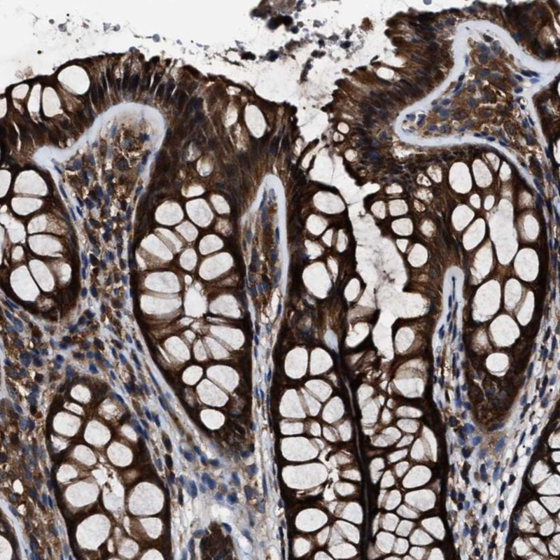 Immunohistochemical staining of human colon shows strong cytoplasmic positivity in glandular cells.